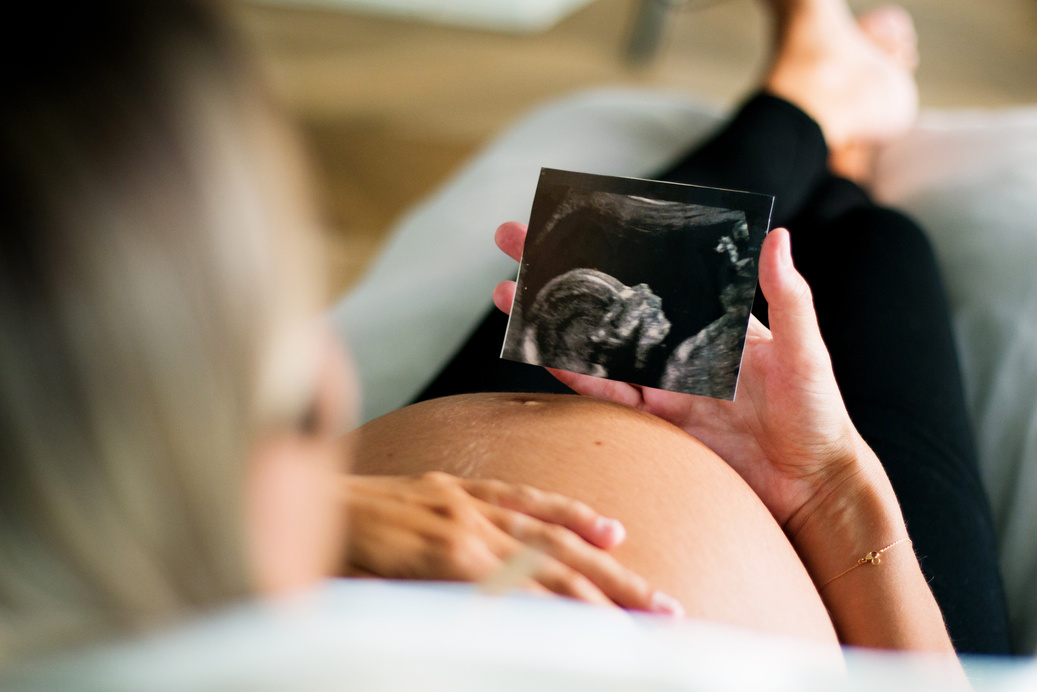 Pregnant Woman Holding an Ultra Sound Picture of Unborn Child